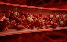 What is metabolic syndrome?