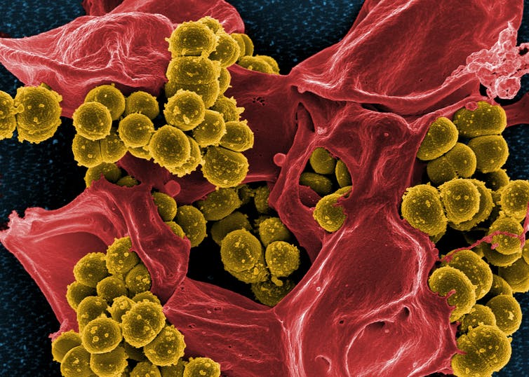 Microbes: Our tiny, crucial allies