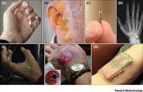 What’s Biohacking? All You Need To Know About The Latest Health Craze
