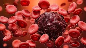 The Forgotten Cancer Cure Hiding in Plain Sight