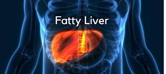 How To Improve Your Health and Fight Fatty Liver